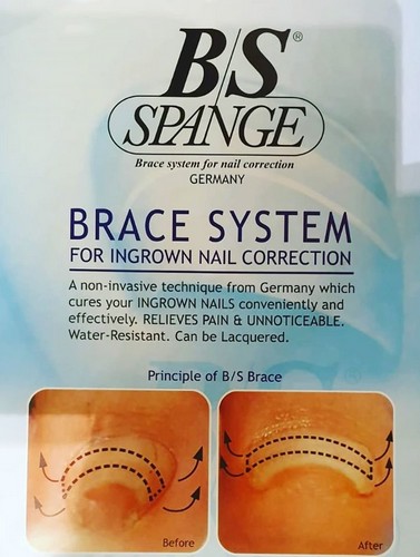 b/s spange